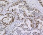 Ki-67 Antibody in Immunohistochemistry (Paraffin) (IHC (P))