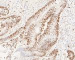 Cyclin D1 Antibody in Immunohistochemistry (Paraffin) (IHC (P))