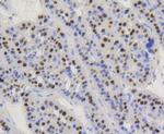 Cyclin D1 Antibody in Immunohistochemistry (Paraffin) (IHC (P))