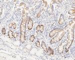 Cyclin D1 Antibody in Immunohistochemistry (Paraffin) (IHC (P))