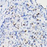 Cyclin D1 Antibody in Immunohistochemistry (Paraffin) (IHC (P))