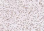 PCNA Antibody in Immunohistochemistry (Paraffin) (IHC (P))