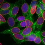 Calreticulin Antibody in Immunocytochemistry (ICC/IF)