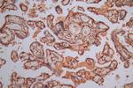 Calreticulin Antibody in Immunohistochemistry (Paraffin) (IHC (P))