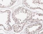 Cyclin D1 Antibody in Immunohistochemistry (Paraffin) (IHC (P))