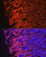 NQO1 Antibody in Immunocytochemistry (ICC/IF)