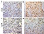 Ki-67 Antibody in Immunohistochemistry (Paraffin) (IHC (P))