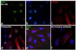 Ki-67 Antibody