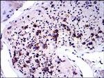 NQO1 Antibody in Immunohistochemistry (Paraffin) (IHC (P))