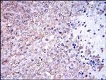 NQO1 Antibody in Immunohistochemistry (Paraffin) (IHC (P))