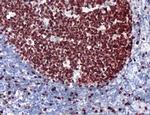 Ki-67 Antibody in Immunohistochemistry (Paraffin) (IHC (P))