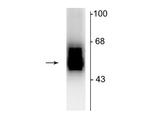 GABRB2 Antibody in Western Blot (WB)