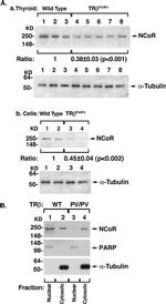 NCoR1 Antibody in Western Blot (WB)