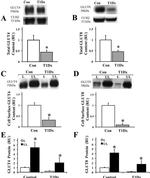 Calreticulin Antibody in Western Blot (WB)