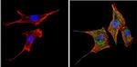 PPAR gamma Antibody in Immunocytochemistry (ICC/IF)