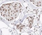 Phospho-Cyclin D1 (Thr286) Antibody in Immunohistochemistry (Paraffin) (IHC (P))