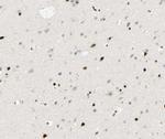 Phospho-PPAR gamma (Ser112) Antibody in Immunohistochemistry (Paraffin) (IHC (P))