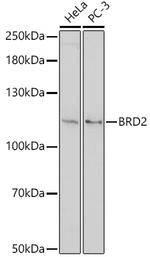 BRD2 Antibody in Western Blot (WB)