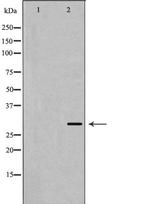 KChIP3 Antibody in Western Blot (WB)