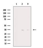 Cyclin D1 Antibody in Western Blot (WB)