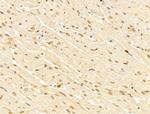 GABPB1 Antibody in Immunohistochemistry (Paraffin) (IHC (P))