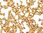 GABPB1 Antibody in Immunohistochemistry (Paraffin) (IHC (P))