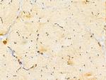 GABPB1 Antibody in Immunohistochemistry (Paraffin) (IHC (P))