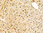 GABPB1 Antibody in Immunohistochemistry (Paraffin) (IHC (P))