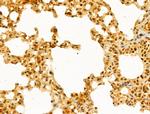 GABPB1 Antibody in Immunohistochemistry (Paraffin) (IHC (P))