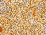 GABPB1 Antibody in Immunohistochemistry (Paraffin) (IHC (P))