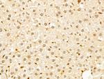 GABPB1 Antibody in Immunohistochemistry (Paraffin) (IHC (P))