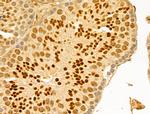 GABPB1 Antibody in Immunohistochemistry (Paraffin) (IHC (P))