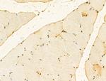 GABPB1 Antibody in Immunohistochemistry (Paraffin) (IHC (P))