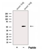 GABPB1 Antibody in Western Blot (WB)