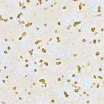 Lamin A/C Antibody in Immunohistochemistry (Paraffin) (IHC (P))