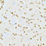 Lamin A/C Antibody in Immunohistochemistry (Paraffin) (IHC (P))