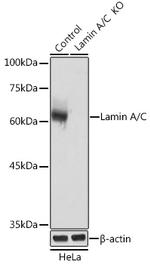 Lamin A/C Antibody