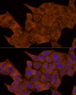 GSDMD Antibody in Immunocytochemistry (ICC/IF)