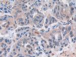 MX1 Antibody in Immunohistochemistry (Paraffin) (IHC (P))