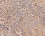 GSDMD Antibody in Immunohistochemistry (Paraffin) (IHC (P))