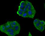 NOX2 Antibody in Immunocytochemistry (ICC/IF)