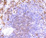 NOX2 Antibody in Immunohistochemistry (Paraffin) (IHC (P))