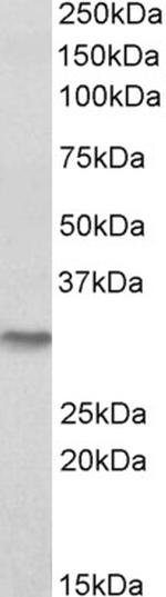 NQO1 Antibody in Western Blot (WB)