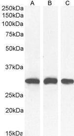 NQO1 Antibody in Western Blot (WB)