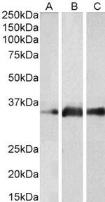 Kallikrein 5 Antibody in Western Blot (WB)