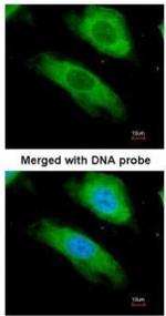 NQO1 Antibody in Immunocytochemistry (ICC/IF)