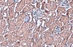 NQO1 Antibody in Immunohistochemistry (Paraffin) (IHC (P))