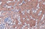 NQO1 Antibody in Immunohistochemistry (Paraffin) (IHC (P))