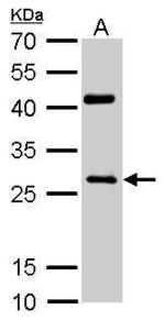 NQO1 Antibody in Western Blot (WB)