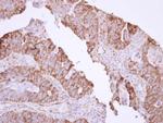 MX1 Antibody in Immunohistochemistry (Paraffin) (IHC (P))